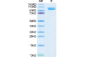 SDS-PAGE (SDS) image for Folate Hydrolase (Prostate-Specific Membrane Antigen) 1 (FOLH1) (AA 44-750) protein (His tag,Biotin) (ABIN7275489)