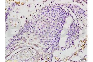 Formalin-fixed and paraffin embedded mouse embryo labeled with Rabbit Anti EphA7/Eph receptor A7 Polyclonal Antibody, Unconjugated (ABIN722005) at 1:200 followed by conjugation to the secondary antibody and DAB staining (EPH Receptor A7 antibody  (AA 181-280))