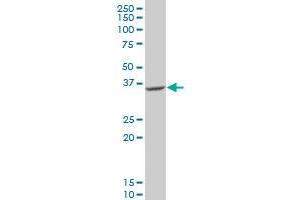 GDAP1 antibody  (AA 158-257)