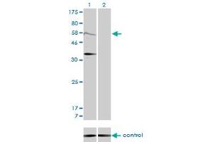 Western blot analysis of MDM2 over-expressed 293 cell line, cotransfected with MDM2 Validated Chimera RNAi (Lane 2) or non-transfected control (Lane 1). (MDM2 antibody  (AA 101-200))