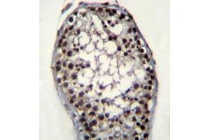 Immunohistochemistry analysis in formalin fixed and paraffin embedded human testis tissue reacted with Glycerol kinase Antibody (N-term) followed by peroxidase conjugation of the secondary antibody and DAB staining. (Glycerol Kinase antibody  (N-Term))
