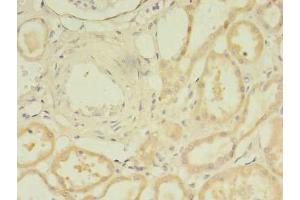 Immunohistochemistry of paraffin-embedded human kidney tissue using ABIN7172078 at dilution of 1:100 (TARS2 antibody  (AA 369-718))