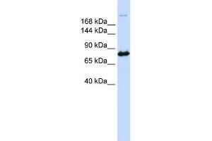 Western Blotting (WB) image for anti-Carbamoyl-Phosphate Synthetase 2, Aspartate Transcarbamylase, and Dihydroorotase (CAD) (N-Term) antibody (ABIN2782488)