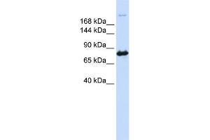 WB Suggested Anti-CAD Antibody Titration:  0. (CAD antibody  (N-Term))