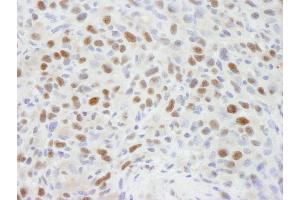 anti-Retinoblastoma Binding Protein 7 (RBBP7) (C-Term) antibody