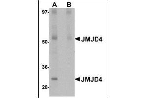 Western blot analysis of JMJD4 in human spleen tissue lysate with this product at 1 μg/ml in (A) the absence and (B) the presence of blocking peptide.
