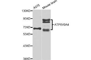 Western blot analysis of extracts of various cell lines, using ATP6V0A4 antibody (ABIN5974639) at 1/1000 dilution. (ATP6V0A4 antibody)