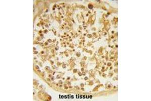 Immunohistochemistry (IHC) image for anti-DAZ Interacting Protein 1 (DZIP1) antibody (ABIN3003968) (DZIP1 antibody)
