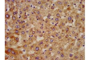 IHC image of ABIN7155981 diluted at 1:300 and staining in paraffin-embedded human liver tissue performed on a Leica BondTM system.