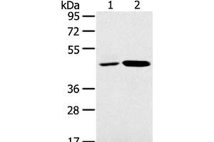 Western Blot analysis of K562 and Jurkat cell using SNX5 Polyclonal Antibody at dilution of 1:250 (SNX5 antibody)