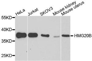 Western blot analysis of extracts of various cell lines, using HMG20B antibody. (HMG20B antibody  (AA 1-317))