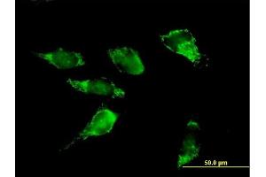 Immunofluorescence of purified MaxPab antibody to PDHA2 on HeLa cell. (PDHA2 antibody  (AA 1-388))