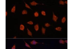 Immunofluorescence analysis of L929 cells using KCNAB2 Polyclonal Antibody at dilution of 1:100. (KCNAB2 antibody)