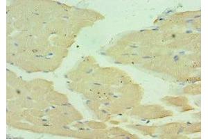 Immunohistochemistry of paraffin-embedded human skeletal muscle tissue using ABIN7160559 at dilution of 1:100 (MYH1 antibody  (AA 1-100))