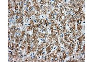 Image no. 4 for anti-Aryl Hydrocarbon Receptor Nuclear Translocator (ARNT) antibody (ABIN1496729) (ARNT antibody)