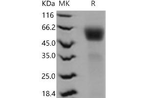 Western Blotting (WB) image for Interleukin 1 Receptor, Type I (IL1R1) (Active) protein (His tag) (ABIN7196337)