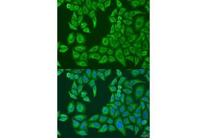 Immunofluorescence (IF) image for anti-ATP-Binding Cassette, Sub-Family F (GCN20), Member 2 (ABCF2) (AA 1-250) antibody (ABIN1678513)