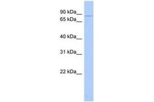 Image no. 1 for anti-Choroideremia (Rab Escort Protein 1) (CHM) (AA 35-84) antibody (ABIN6744369) (CHM antibody  (AA 35-84))