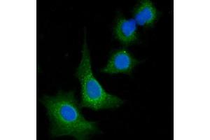 IF analysis of VPS53 using anti-VPS53 antibody (ABIN7599731). (VPS53 antibody  (AA 11-699))