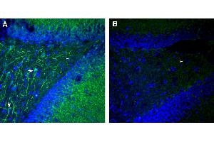 anti-Plexin B1 (PLXNB1) (AA 1159-1174), (Extracellular), (N-Term) antibody