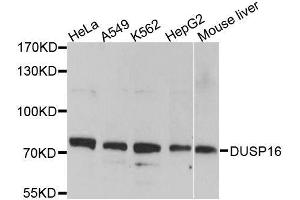 Western blot analysis of extracts of various cell lines, using DUSP16 antibody. (DUSP16 antibody  (AA 416-665))