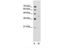 Image no. 1 for anti-GNAS Complex Locus (GNAS) (AA 297-346) antibody (ABIN203496) (GNAS antibody  (AA 297-346))