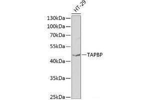 Western blot analysis of extracts of HT-29 cells using TAPBP Polyclonal Antibody at dilution of 1:1000.