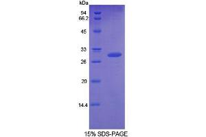 SDS-PAGE analysis of Rat GDF11 Protein. (GDF11 Protein)