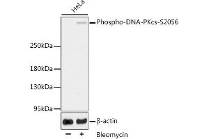Western blot analysis of extracts of HeLa cells, using Phospho-DNA-PKcs-S2056 antibody (ABIN6135292, ABIN6136206, ABIN6136207 and ABIN6225632). (PRKDC antibody  (pSer2056))