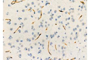 ABIN6264216 and ABIN6273297 at 1/100 staining Rat brain tissue by IHC-P. (PIK3IP1 antibody  (N-Term))
