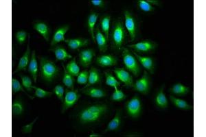 Immunofluorescence staining of A549 cells with ABIN7160061 at 1:133, counter-stained with DAPI.