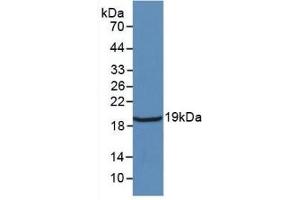 Detection of Recombinant IL18, Rat using Monoclonal Antibody to Interleukin 18 (IL18) (IL-18 antibody  (AA 37-194))