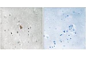 Immunohistochemistry analysis of paraffin-embedded human brain, using IGF1R (Phospho-Tyr1346) Antibody. (IGF1R antibody  (pTyr1346))