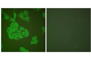 Immunofluorescence analysis of A549 cells, using MMP11 antibody (ABIN5976457). (MMP11 antibody  (Internal Region))