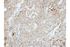 IHC-P Image Immunohistochemical analysis of paraffin-embedded BT474 xenograft, using PCDH1, antibody at 1:100 dilution. (Protocadherin 1 antibody  (C-Term))