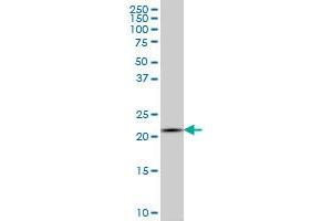 IL20 monoclonal antibody (M01), clone 2H8 Western Blot analysis of IL20 expression in K-562 . (IL-20 antibody  (AA 67-176))