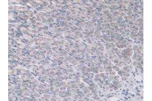 Detection of ADAMTS7 in Mouse Stomach Tissue using Polyclonal Antibody to A Disintegrin And Metalloproteinase With Thrombospondin 7 (ADAMTS7) (ADAMTS7 antibody  (AA 226-437))