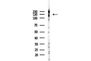 anti-Regulator of G-Protein Signaling 22 (RGS22) (Internal Region) antibody