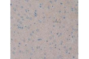 Figure. (NOG antibody  (AA 28-144))