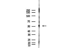 Western blot analysis of lysates from Hela cells(LPS, 4h treatment), using Cytokeratin 8 Antibody at 1/1000 dilution.