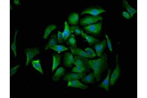 Immunofluorescence staining of A549 cells with ABIN7149542 at 1:530, counter-stained with DAPI. (CRADD antibody  (AA 1-199))