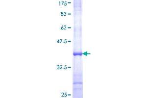 AOC2 Protein (AA 169-268) (GST tag)