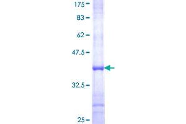 AOC2 Protein (AA 169-268) (GST tag)