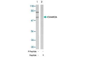 Western blot analysis of extracts from mouse brain tissue using CAMK2A polyclonal antibody . (CAMK2A antibody)