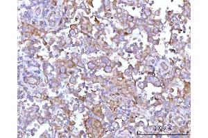 IHC analysis of RPS15A using anti-RPS15A antibody (ABIN7598954). (RPS15A antibody  (AA 1-113))