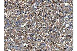 IHC analysis of PPP2R1A using anti-PPP2R1A antibody (ABIN7603081).