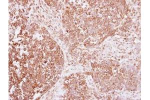 Image no. 1 for anti-Insulin Receptor (INSR) (AA 816-988) antibody (ABIN1498892) (Insulin Receptor antibody  (AA 816-988))