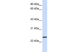 WB Suggested Anti-ERVWE1 Antibody Titration:  0. (ERVW-1 antibody  (N-Term))