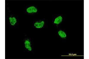 Immunofluorescence of monoclonal antibody to HOXA5 on HeLa cell. (HOXA5 antibody  (AA 171-270))