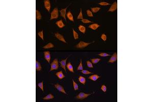 Immunofluorescence analysis of L929 cells using USP5 antibody (ABIN1683231, ABIN3018687, ABIN3018688 and ABIN6220542) at dilution of 1:100. (USP5 antibody  (AA 1-280))